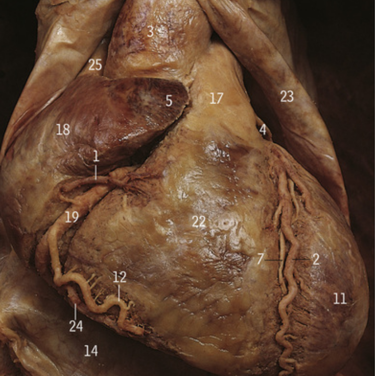 <p>What is 4</p>