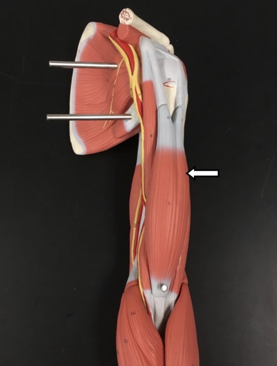 <p><span>Name the muscle labeled with the white arrow below - be specific!</span></p>