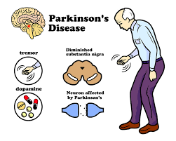 <p><strong>The geriatrician providing care for a 74-year-old man with diagnosis of Parkinson disease has recently changed the client's medication regimen. What is the most likely focus of the pharmacologic treatment of the man's health problem?</strong></p><p>A) Maximizing acetylcholine release from synaptic vesicles at neuromuscular junctions</p><p>B) Preventing demyelination of the efferent cerebellar pathways</p><p>C) Increasing the functional ability of the underactive dopaminergic system</p><p>D) Preventing axonal degradation of motor neurons </p>