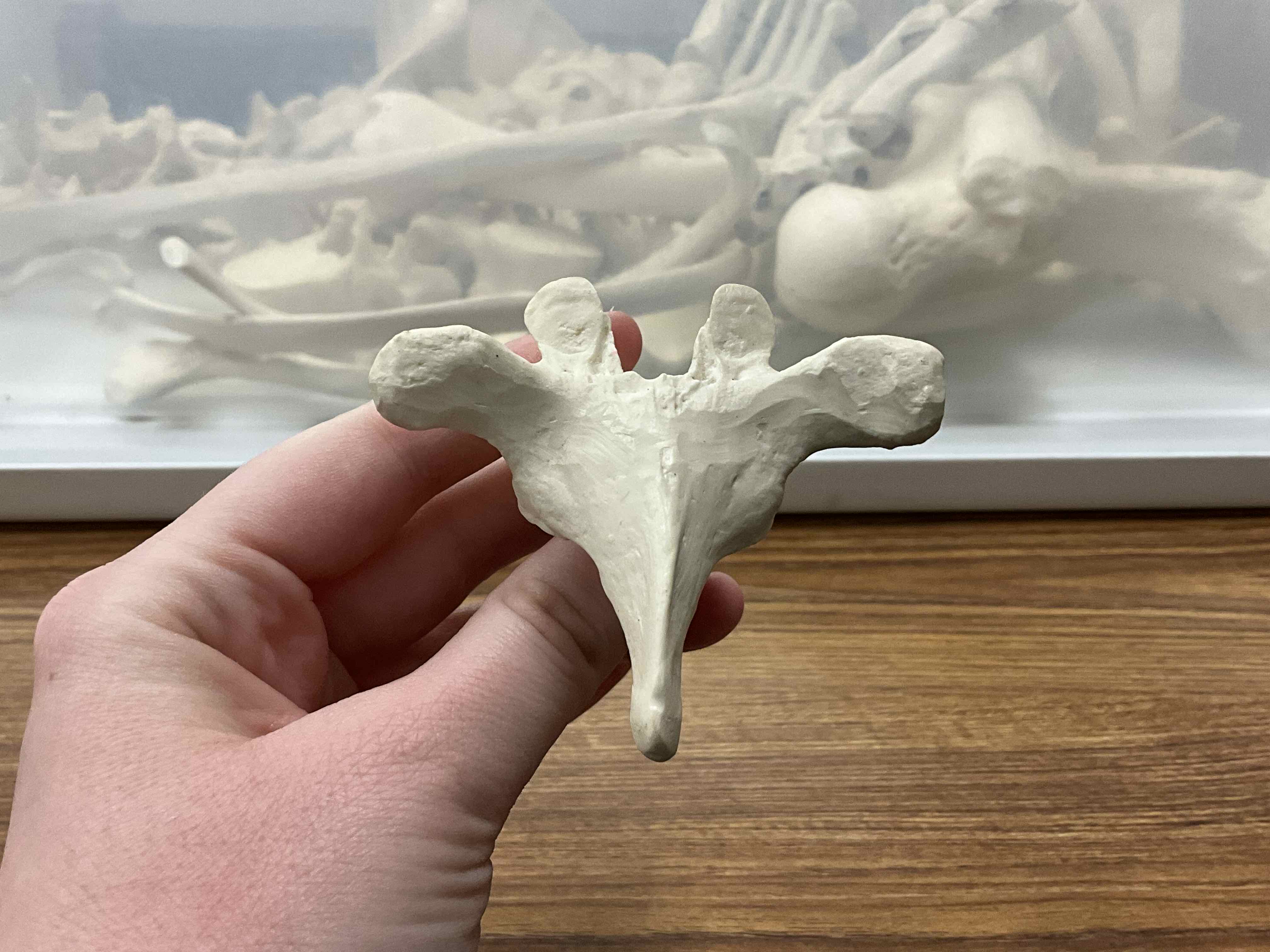 <p>Name this type of vertebrae</p>