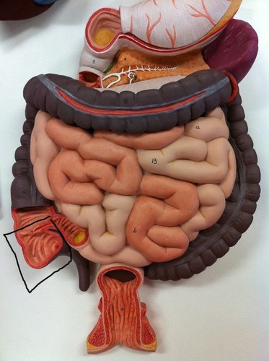 <p>What part of the large intestine is this?</p>