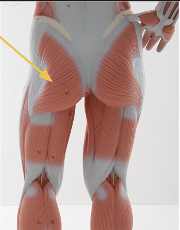 <p>identify + state origin, insertion, action, innervation of marked structure</p>