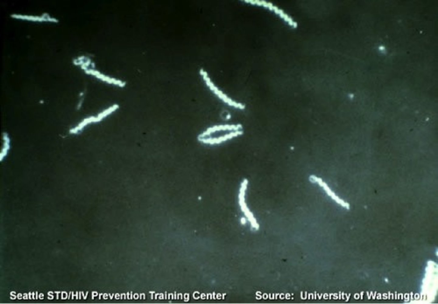 <p>- Light objects are visible against a dark background</p><p>- Similar set-up to Brightfield</p><p>- Useful for diagnosing Treponema palliudum (syphilis)</p><p>- Useful for detecting Vibrio cholerae (cholera) in stool sample</p>