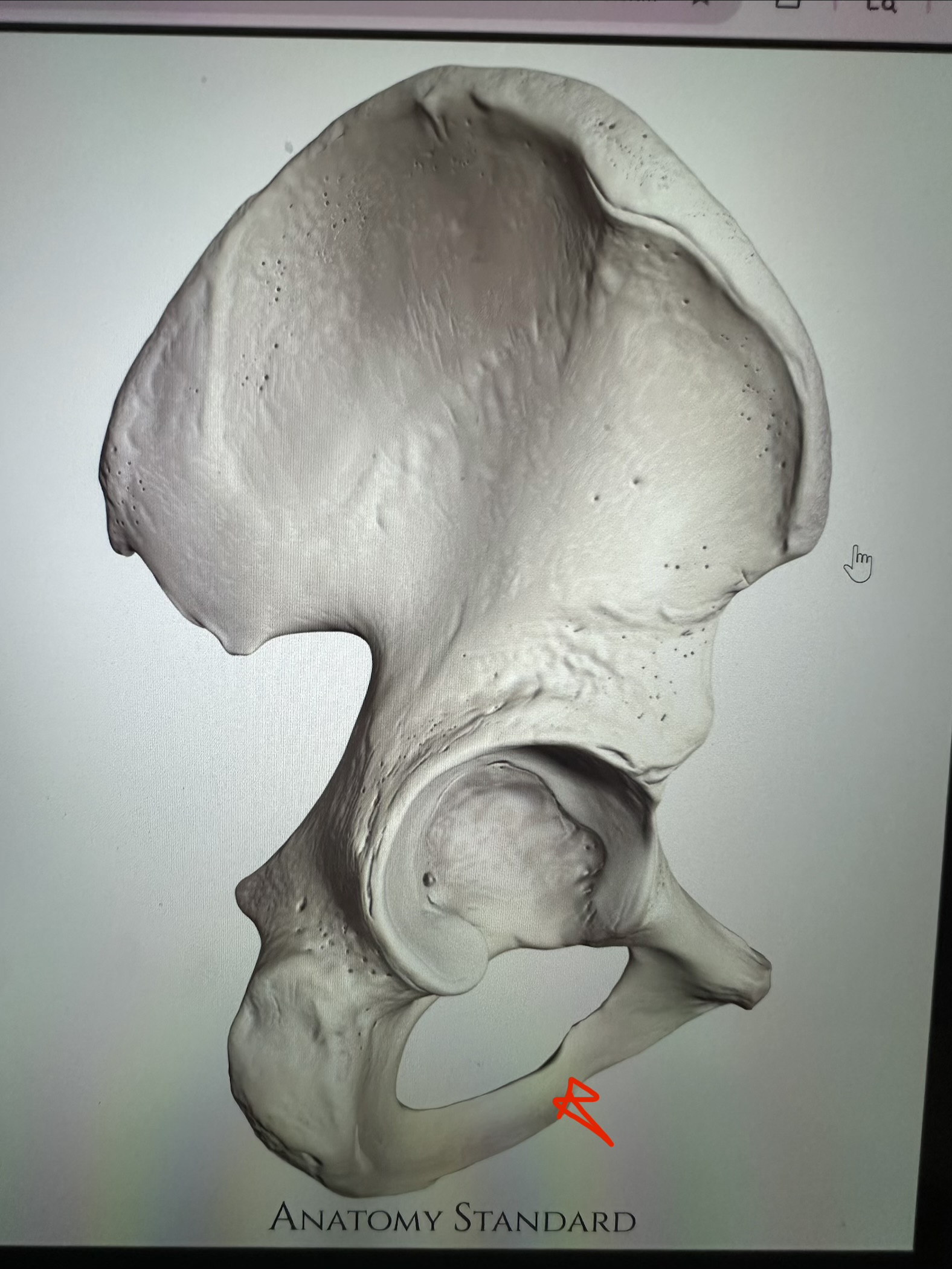<p>os coxae, thin flat bone connecting pubis to ischium</p>