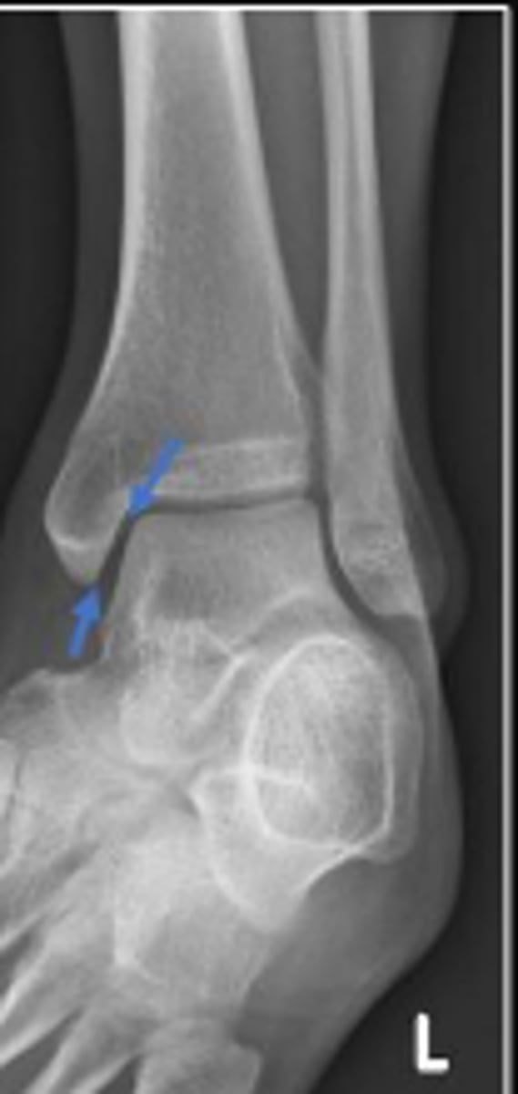 <p>What space are the arrows pointing to?</p>