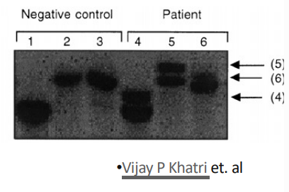 <p>how was southern blot used to detect monoclonal lymphocyte populations? what are the advantages and disadvantages of sblot?</p>