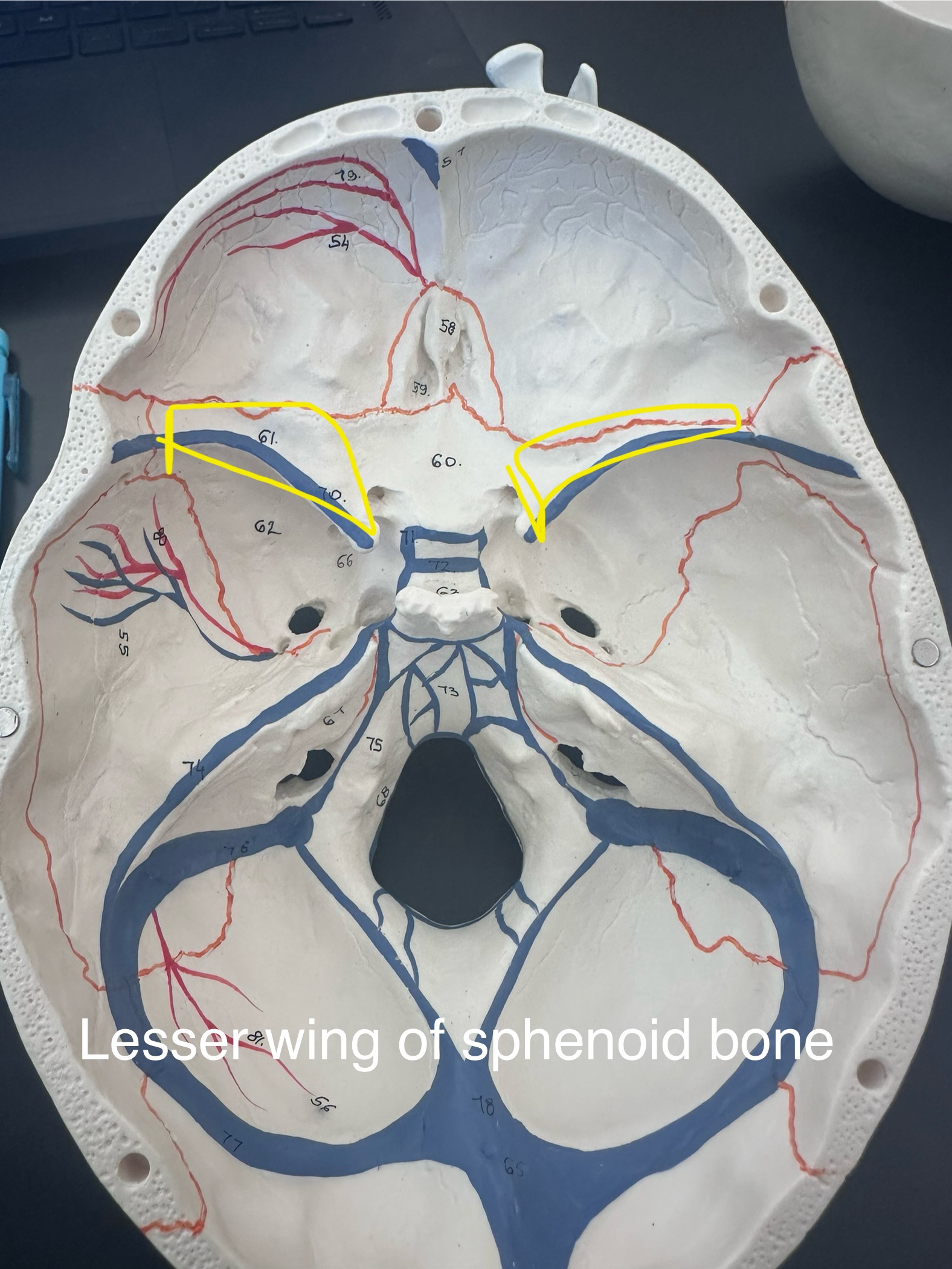 <p>Lesser wing of sphenoid bone</p>