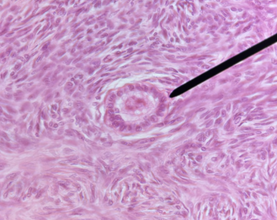 <p>what organ is this from? </p>