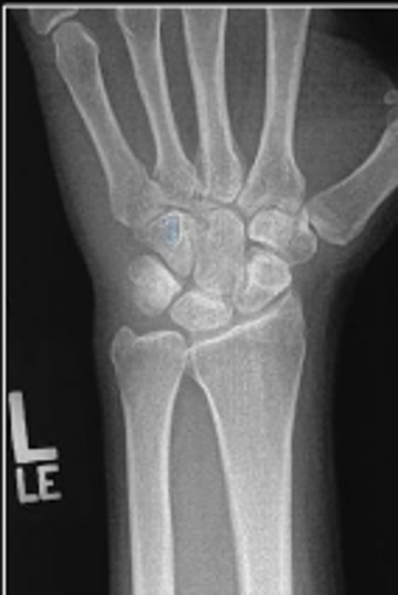 <p>What is outlined?</p>