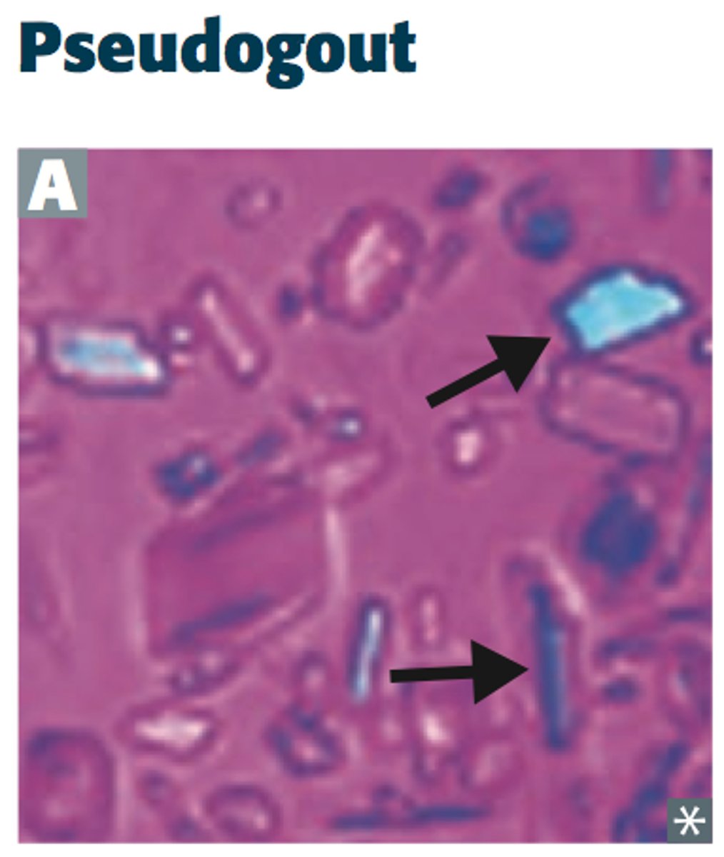 <p>Rhomboid, intracellular or free</p>