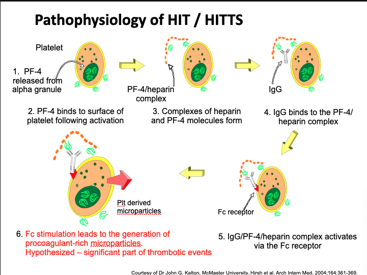 <ul><li><p>PF4 is released from platelet alpha granules upon activation</p></li><li><p>Heparin binds to PF4 → forms PF4/heparin complex</p></li><li><p>IgG antibody binds to this complex</p></li><li><p>Fc portion of IgG binds Fc receptor on platelet</p></li><li><p>This activates platelets → aggregation, granule release</p></li><li><p>Results in thrombocytopenia and procoagulant microparticles</p></li><li><p>These microparticles are thought to drive thrombosis</p></li><li><p>Removal of heparin leads to improvement</p></li></ul><p></p>