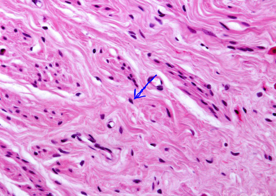 <p>What type of connective tissue is shown in the image?</p>