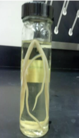<p>Ascaris Lumbricoides </p>