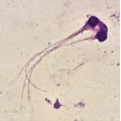 <p>Identify the sperm morphology.</p>