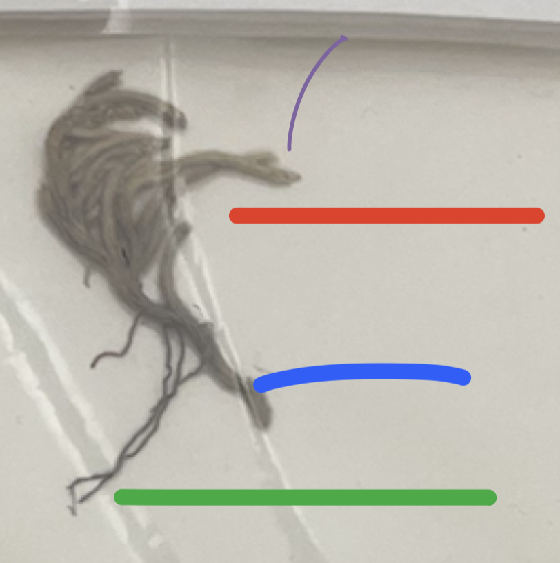 what is the **PURPLE** pointing at?