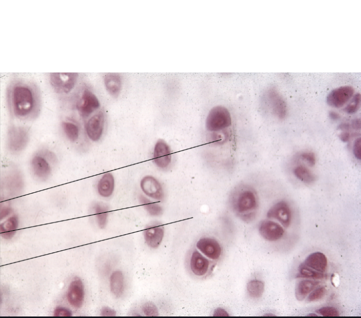 <p>What type of cartilage is this?</p>
