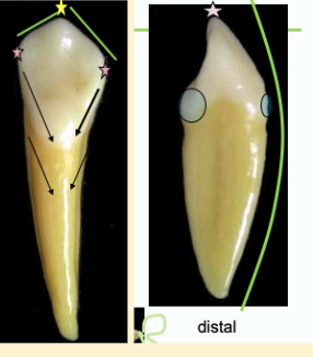 <p><mark data-color="#ffc1ec" style="background-color: #ffc1ec; color: inherit">mandibular canines #22 and #27; root length</mark></p>