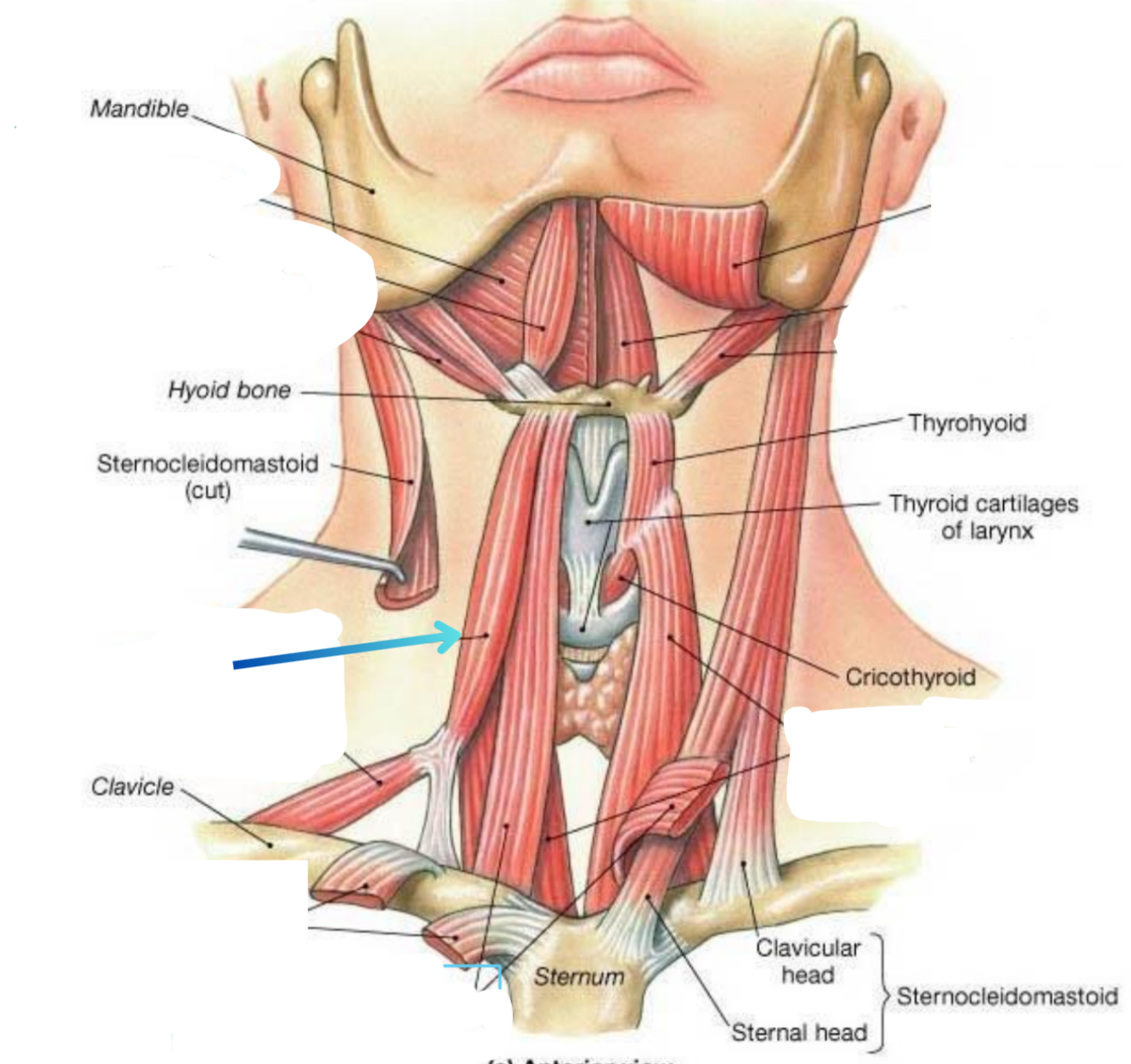term image