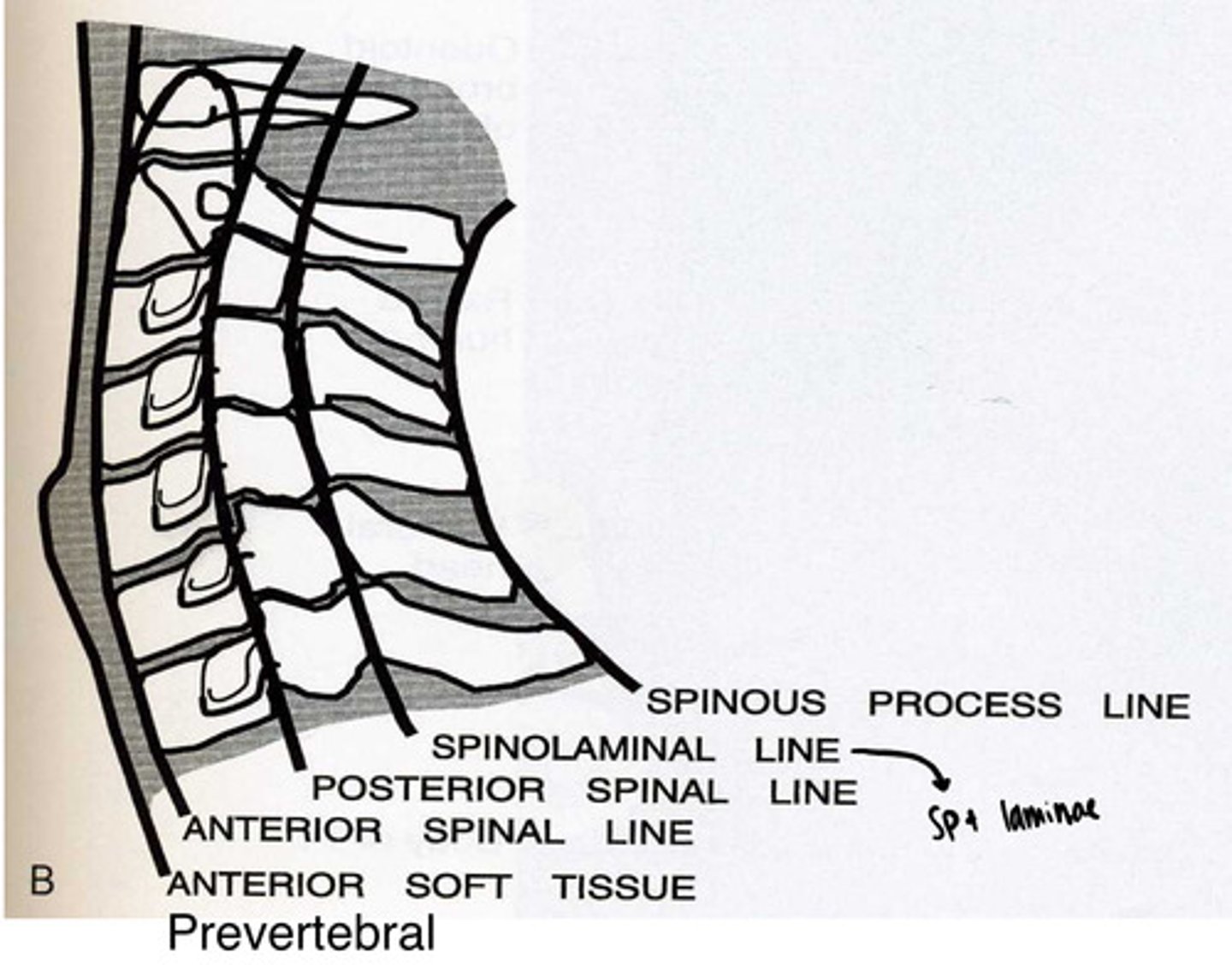 <p>cervical spine lines</p>