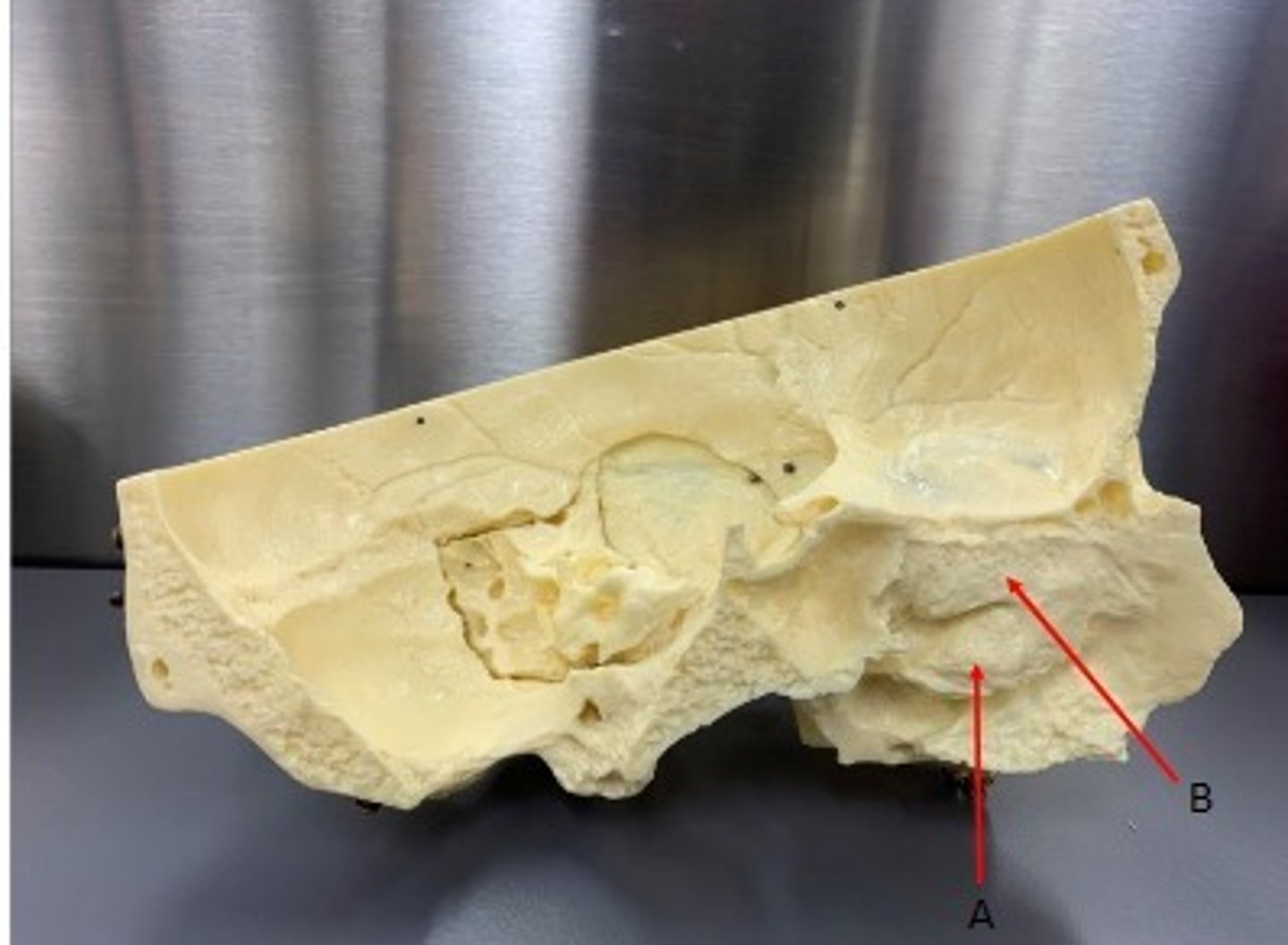 <p>What category of bone is it? What bone is it? Label the structures.</p>