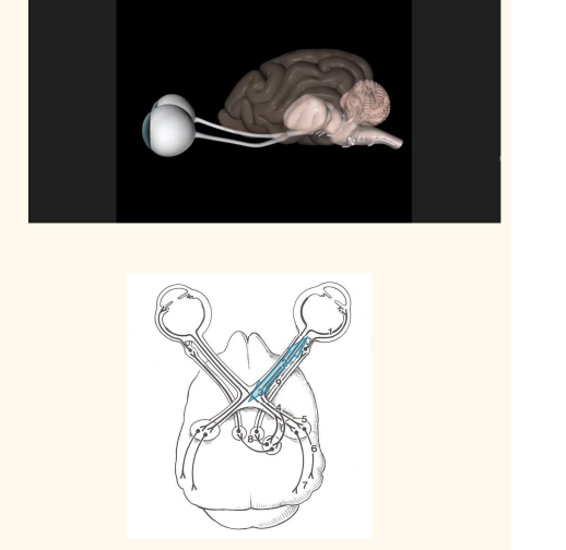 <p>Neuroepithelial cells (rods &amp; cones), bipolar and ganglion cells 2. Optic nerve 3. Optic chiasm 4. Optic tract </p><p></p><p>—&gt;Lesion: blindness and pupillary light reflex (PLR) deficit</p><p></p><p>5 Lateral geniculate nucleus 6. Optic radiation 7. Occipital lobe </p><p>—&gt;Lesion: central blindness</p><p>7a. Pretectal nuclei 8. Edinger-Westphal nucleus 9. CN III – Oculomotor nerve 10. Ciliary ganglion 11. Ciliary nerves 12. Sphincter pupillae muscle </p><ul><li><p> Lesion: mydriasis, lack of response to light stimulus</p></li></ul><p></p>