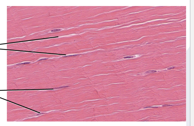 <p>Dense Regular Connective</p><p>collagen fibers in bundles with fibroblasts in rows between bundles&nbsp;</p><p>Function: provides strong attachment between structures&nbsp;</p><p>Found in: forms <strong>tendons, ligaments,</strong> and aponeuroses&nbsp;</p>