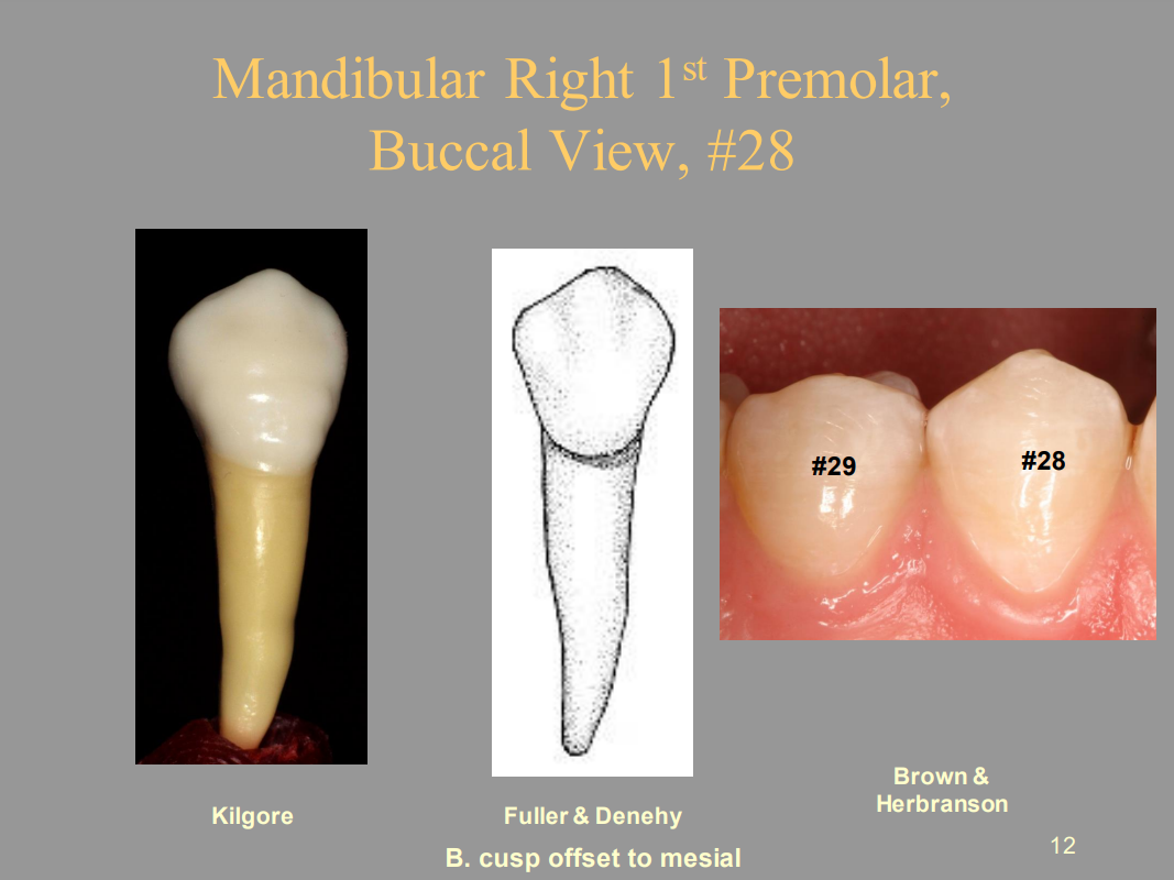 <p>A. Mesial</p>