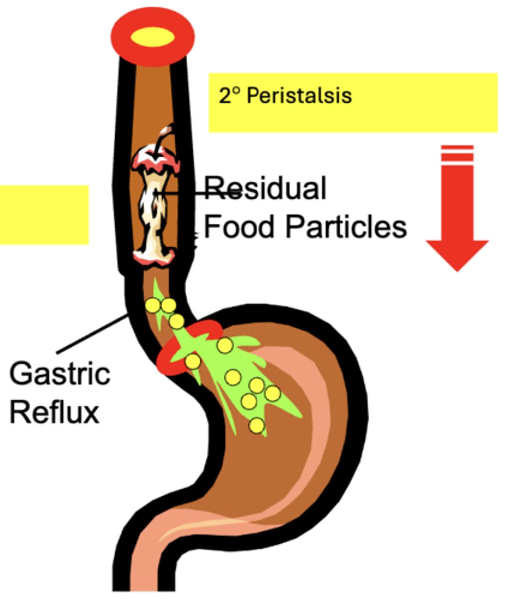 <p>- similar to 1° peristalsis, except it is initiated by distension of the esophagus body by material in the lumen (NOT Pharyngeal Contact)</p><p>function of secondary peristaltic contractions:</p><p>- to clear or "sweep" the esophagus of Residual Food particles remaining after the primary peristaltic wave </p><p>- to remove Gastric Reflux that enters from the stomach</p>
