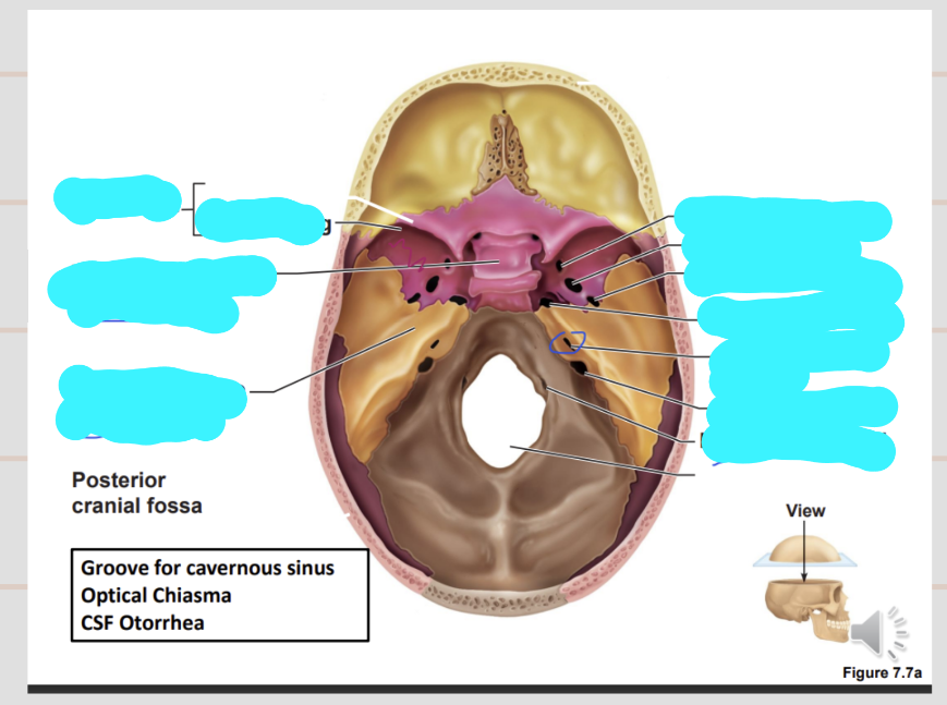 <p>describe the structures in the middle crania fossa</p>