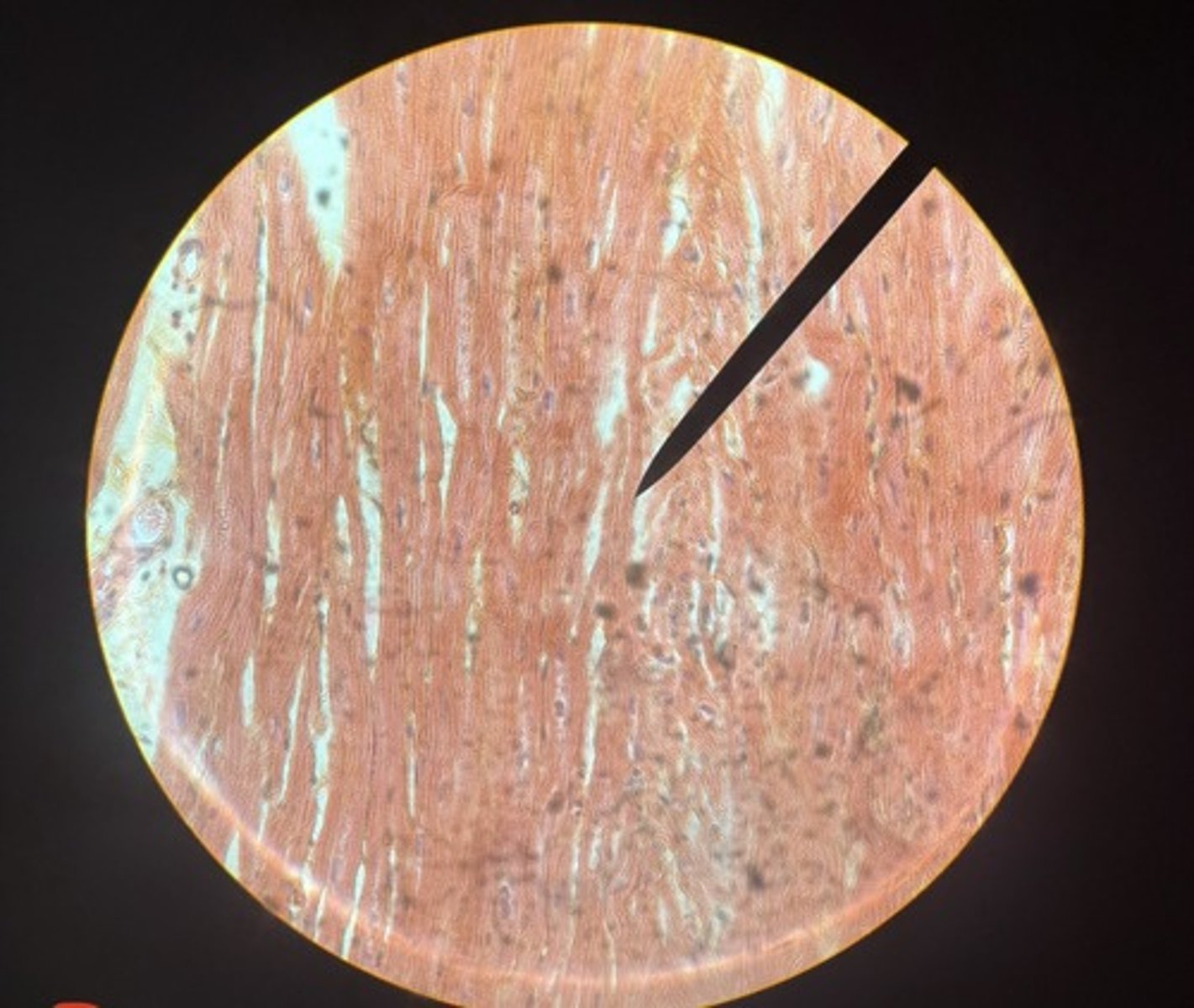<p>What type of muscle is this?</p>