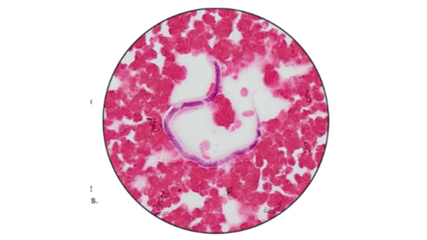<p>Stage of Dirofiliria immitis that are released from adult females & circulate in the blood</p><p>*Can be detected in blood smears from an infected canine host</p>