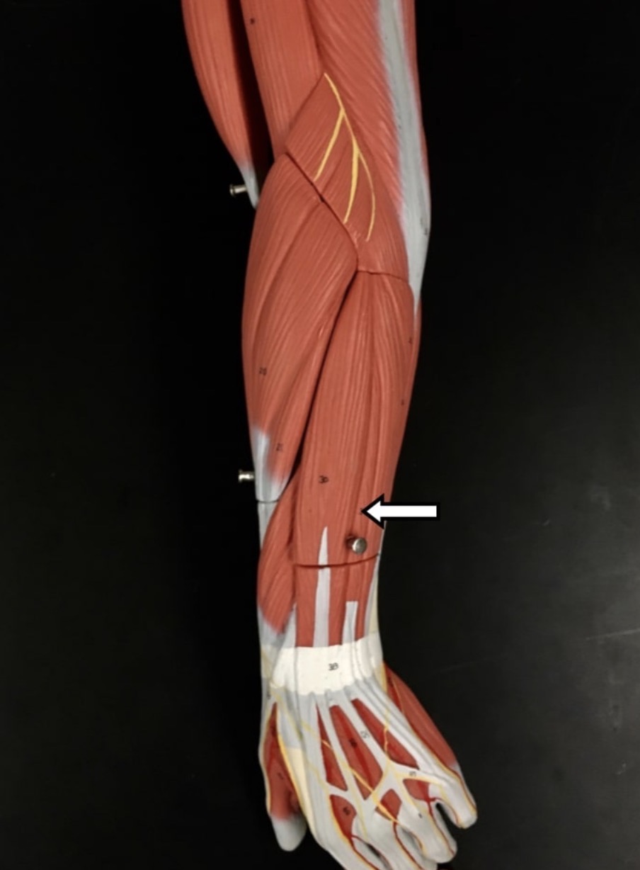 <p><span>Name the muscle labeled with the white arrow below.</span></p>