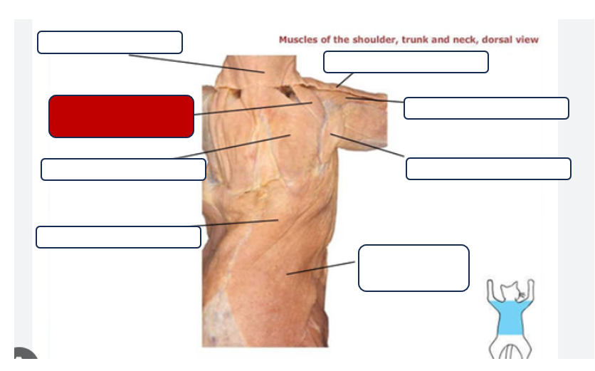 <p>Label the muscle</p>