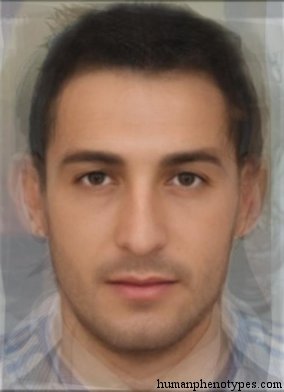 <p>Identify this Phenotype</p>
