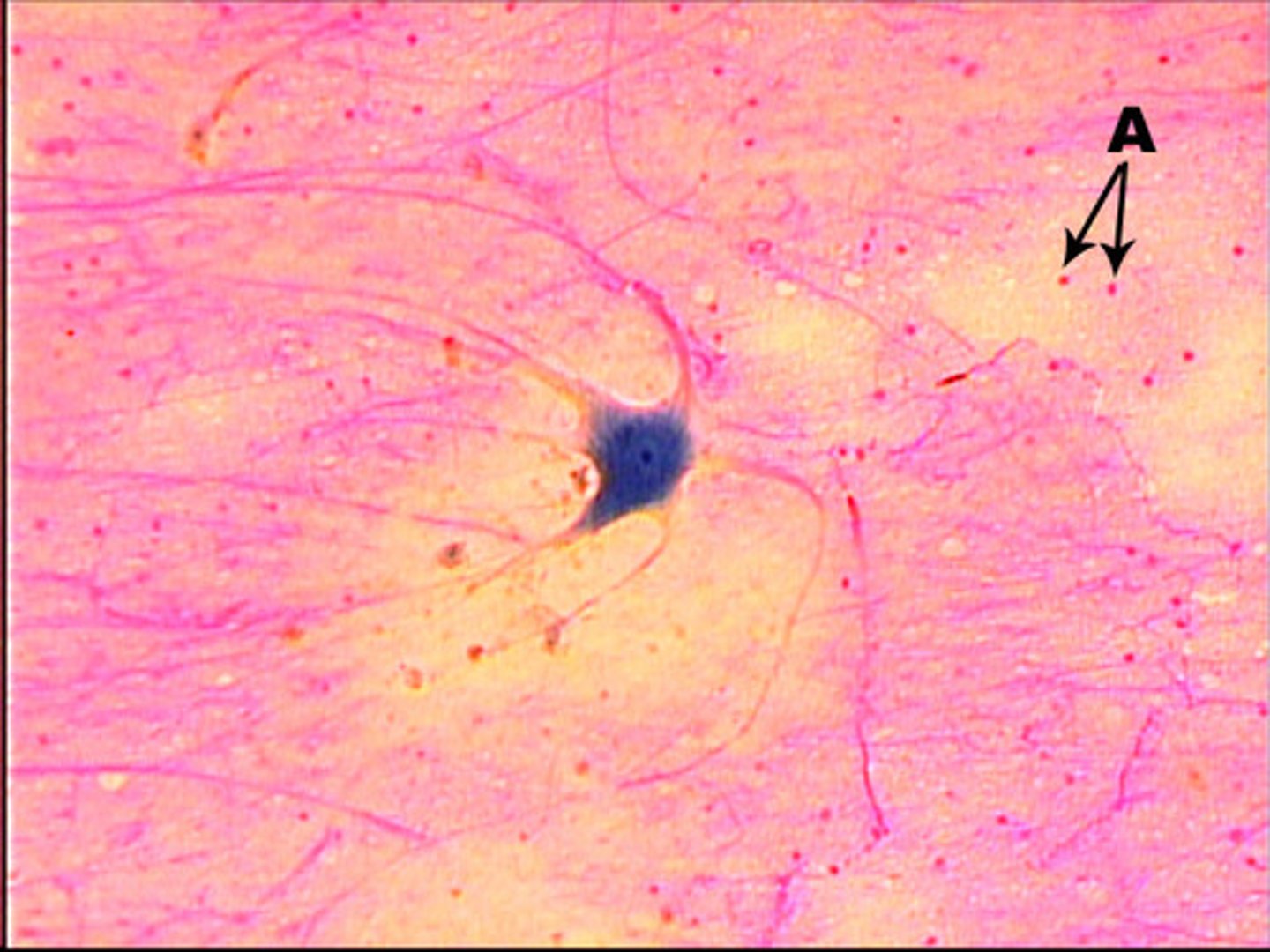 <p>soma-body</p><p>axon-larger branch-transmits impulse from soma</p><p>myelin sheath-surrounds some axons-protective coating made of cholesterol</p><p>dendrites-carry impulse to soma</p><p>synapse-gap between neurons</p><p>found in all nerve tissue, such as brain and spinal cord</p><p>function: conduct an impulse</p>