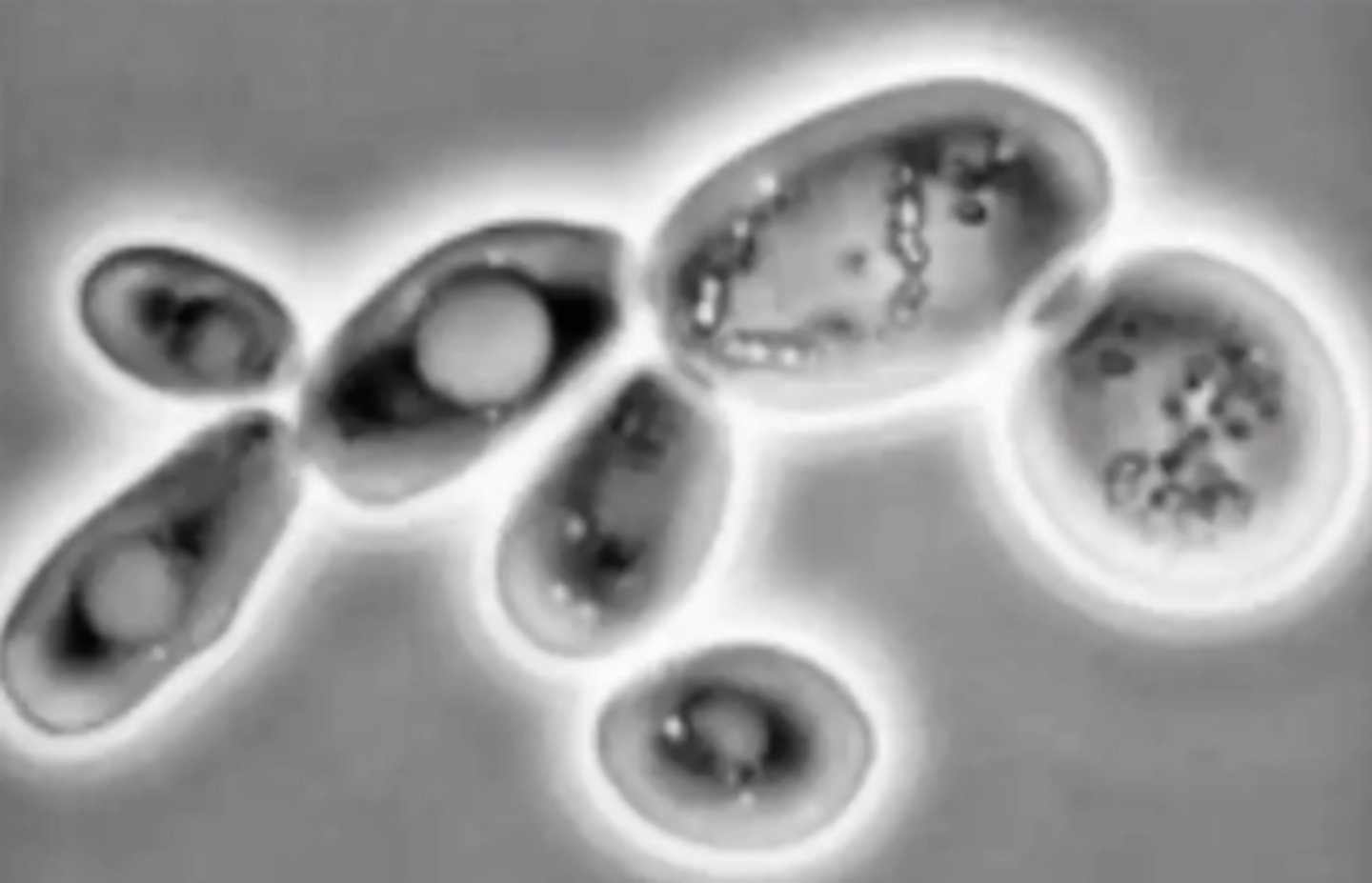 <p>What type of microscopy is shown?</p>
