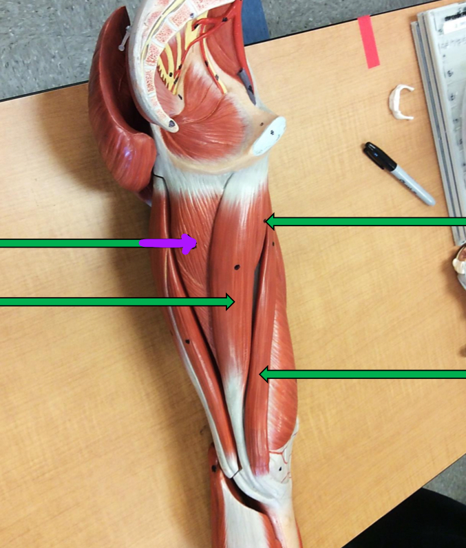 <p>Identify this muscle?</p>