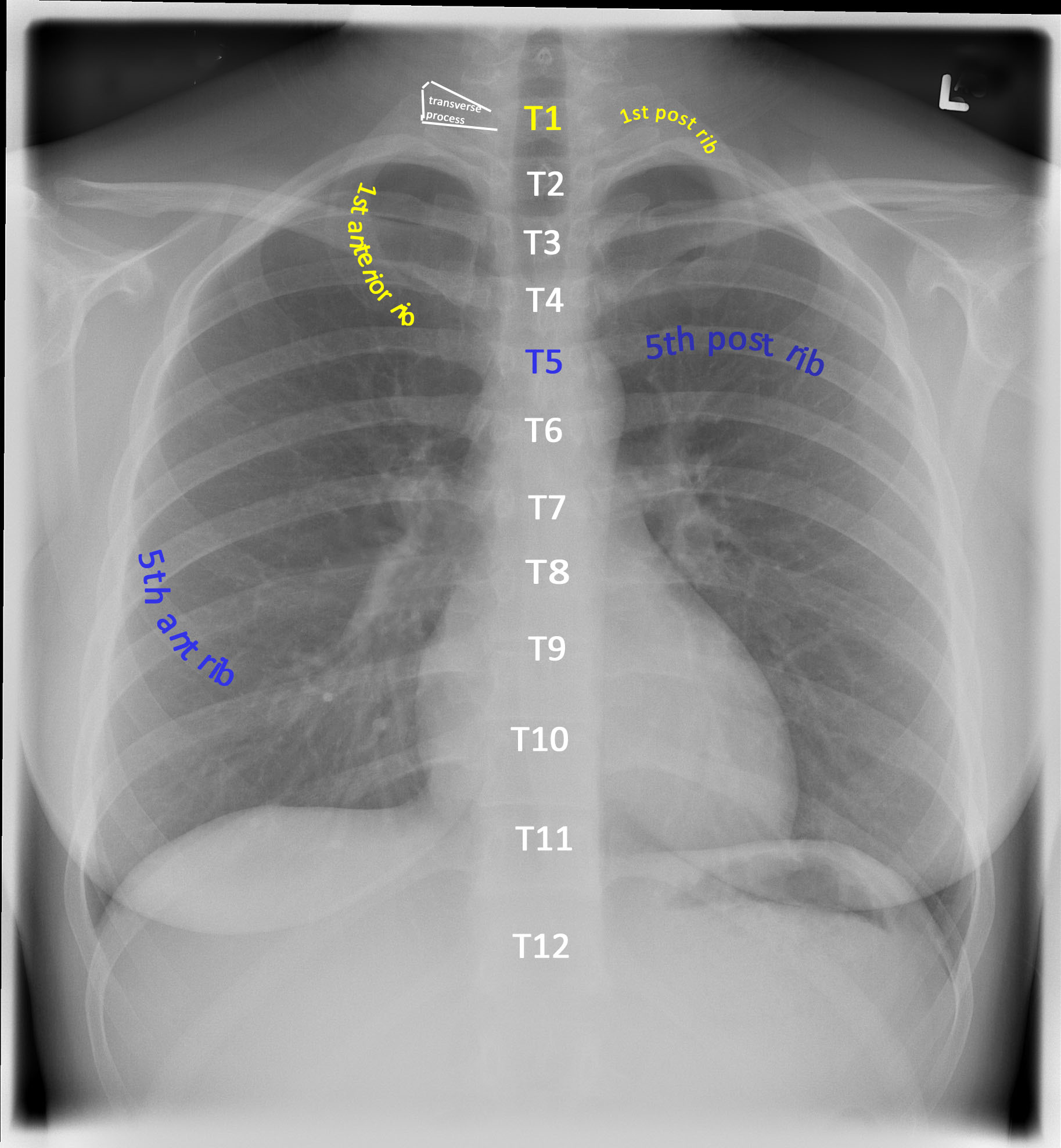 <p>At least 9 full posterior ribs.</p>