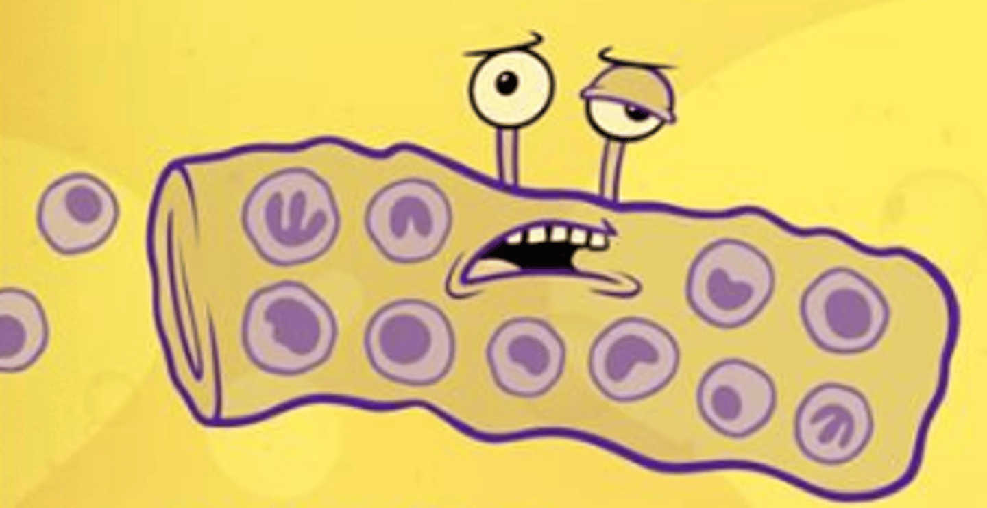 <p>interstitial nephritis, pyelonephritis</p>