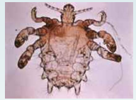<p>Human anoplura </p>