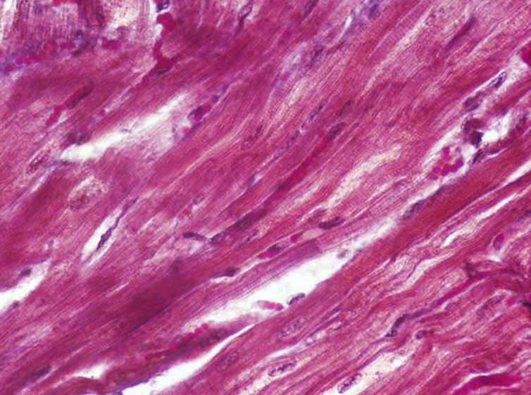 <p>Identify the type of muscle tissue shown?</p>