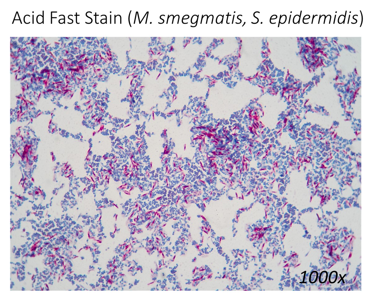 * blue = acid fast (-)
* pink = acid fast (+)