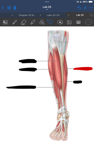 <p>What muscle is this?</p>