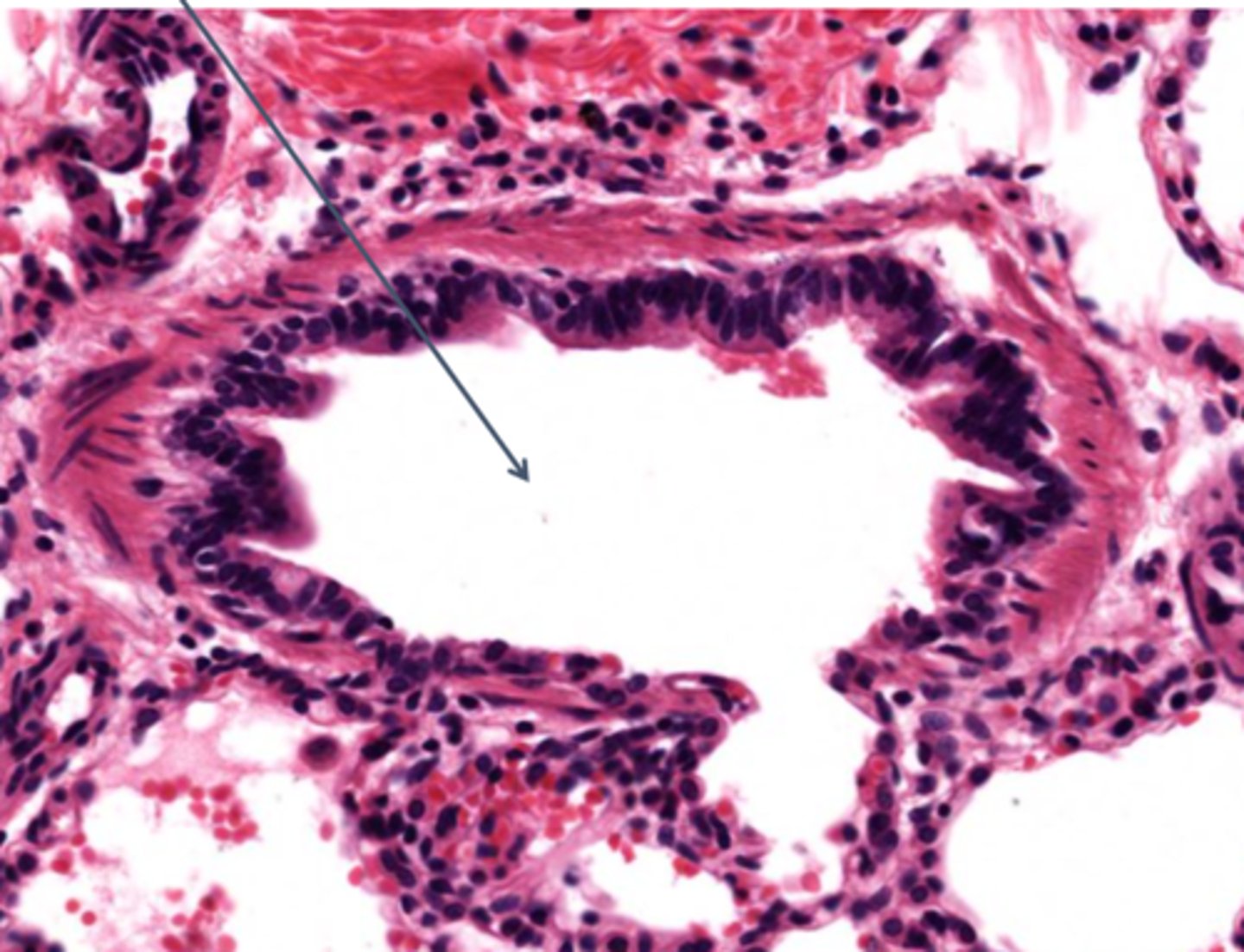 <p>Identify the type of bronchiole</p>