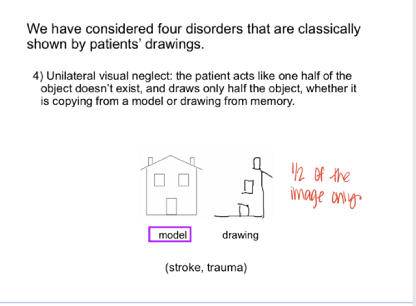 <p>REVIEW: What is unilateral visual neglect?</p>
