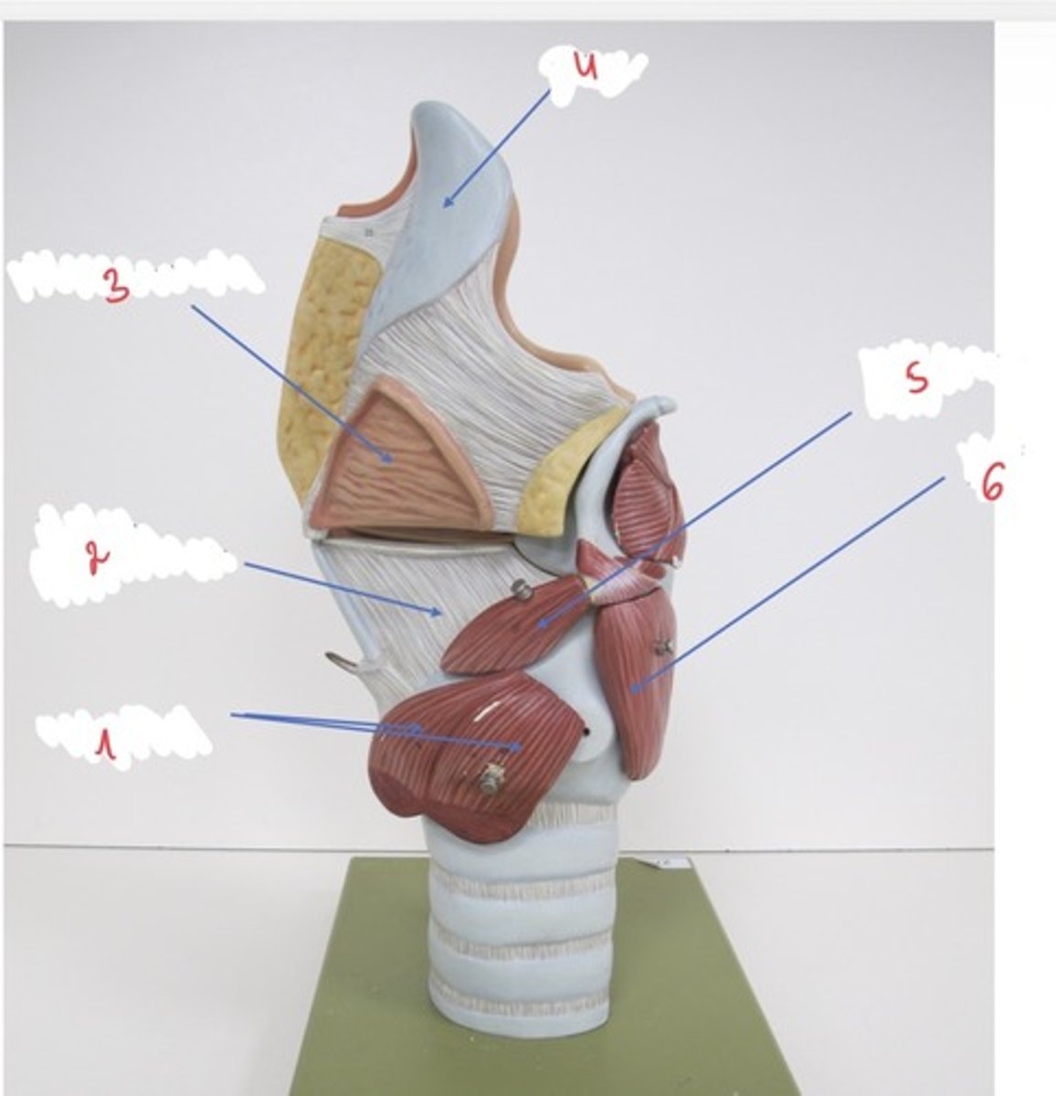 <p>wat wordt er aangeduid met 5</p>