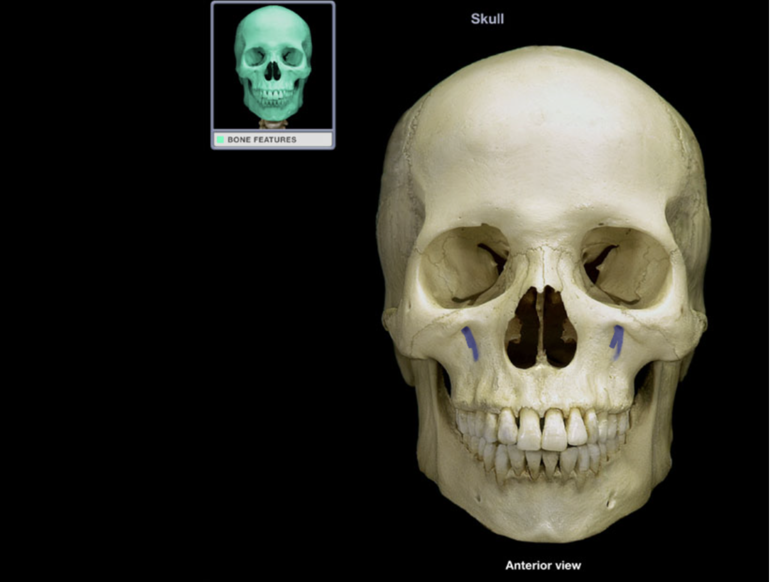 <p>Infraorbital foramen</p>