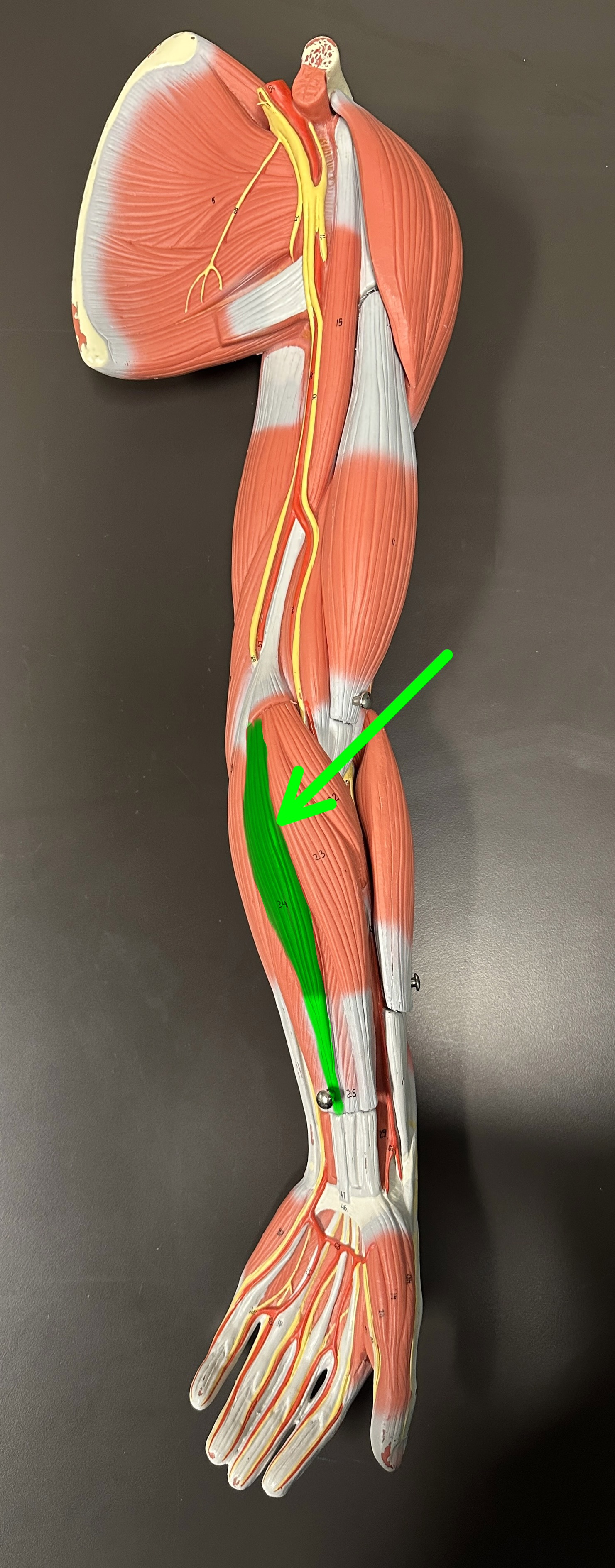 <p>What is the highlighted structure</p>