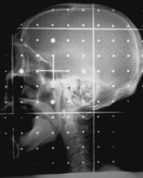 <p>What type of image is this?</p>