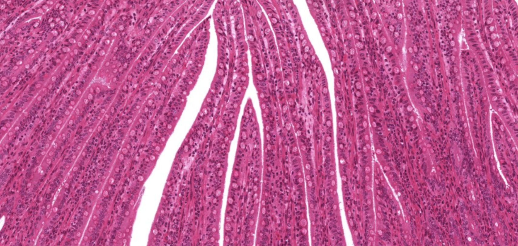 <p>Villi in Jejunum</p>